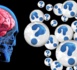 Alzheimer : un indicateur pour les formes précliniques de la maladie
