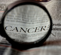 L’Institut national du cancer plaide pour plus de concertation et de partage des recherches