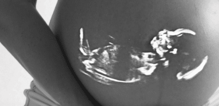 Assaut de demandes et 8 millions d’euros de plus pour les « PMA pour toutes »