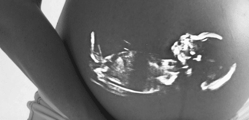 Assaut de demandes et 8 millions d’euros de plus pour les « PMA pour toutes »