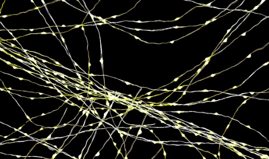 Les signes possiblement avant-coureurs d’AVC à connaitre