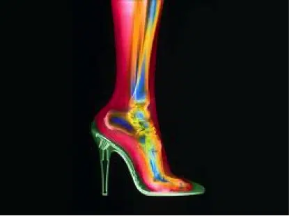 Le talon haut nous fait souffrir