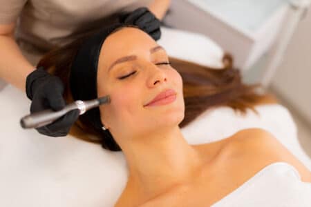Le microneedling à domicile : révolution ou risque pour votre peau ?