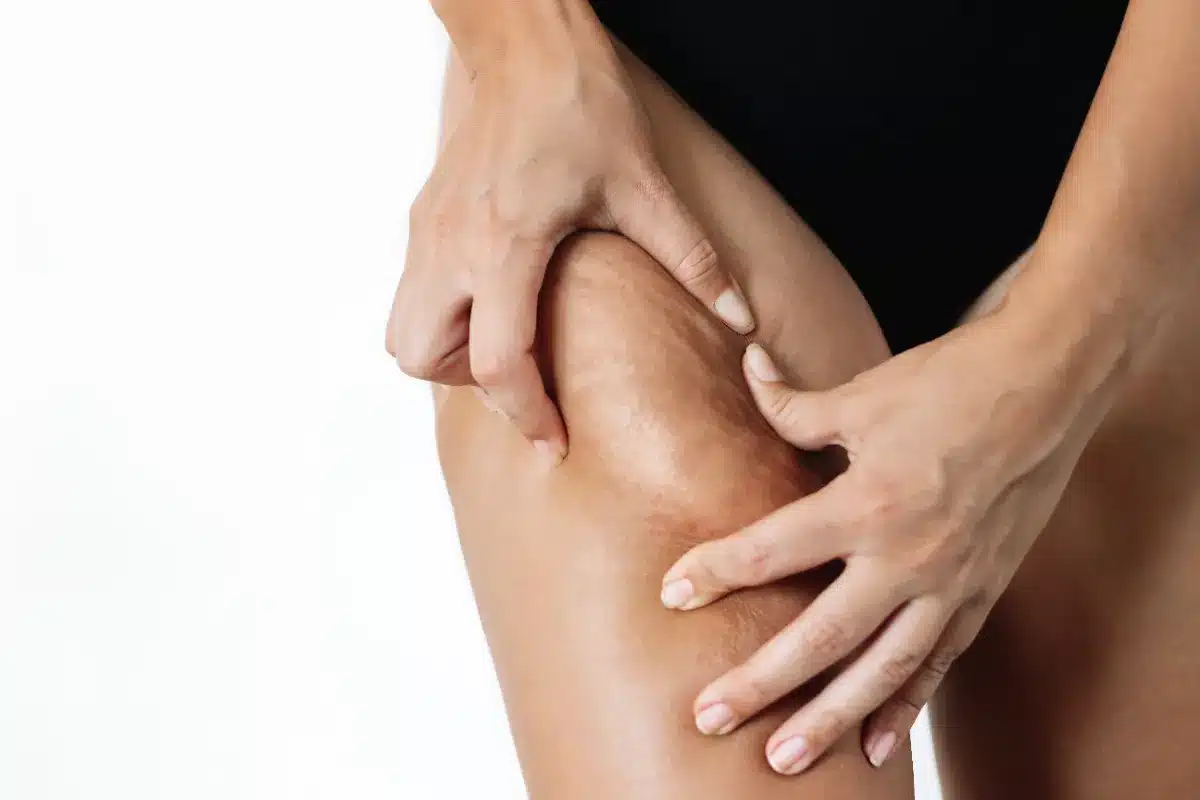Un exercice facile pour se débarrasser de la cellulite : le Nordic curls